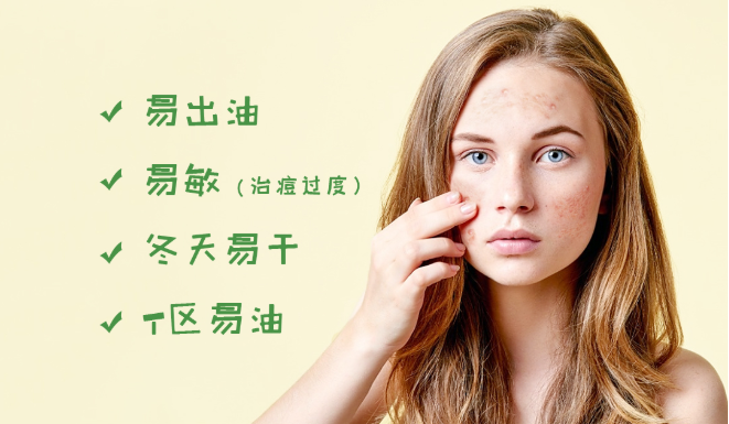 拥有一套祛痘“神器”是怎样的体验？