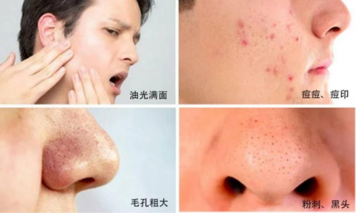 夏季控油除螨，你的帅气由左颜右色来呵护
