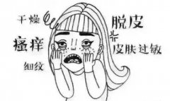 大澳化妆品：春季是过敏高发季节，如何辨别真假过敏